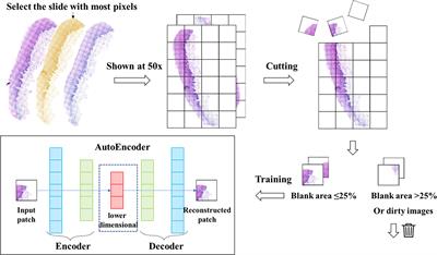 Automatic Detection of Image-Based Features for Immunosuppressive Therapy Response Prediction in Oral Lichen Planus